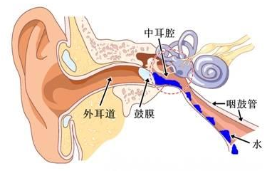 感觉耳朵闷、耳朵堵怎么办？