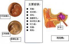 <b>确诊中耳炎病因 医生在线制定诊疗方案</b>