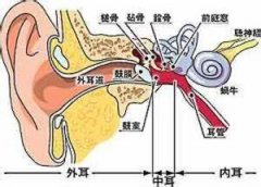 <b>什么是美尼尔综合症?</b>